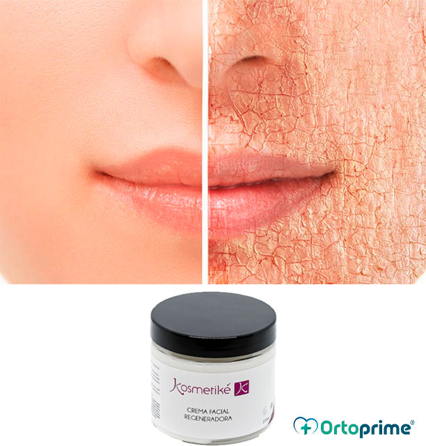 crema-facial-piel-seca-ortoprime